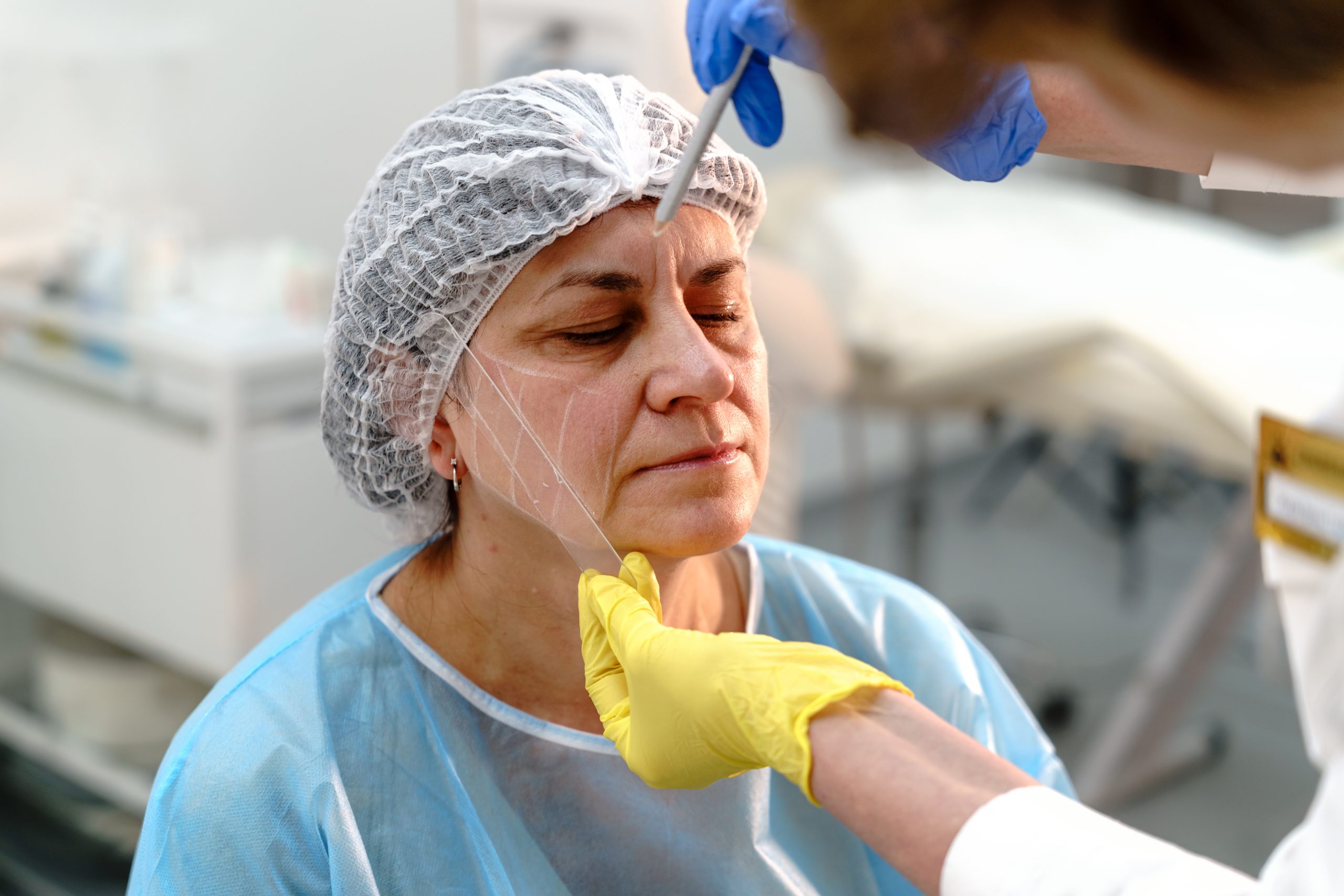 facelift potential risks