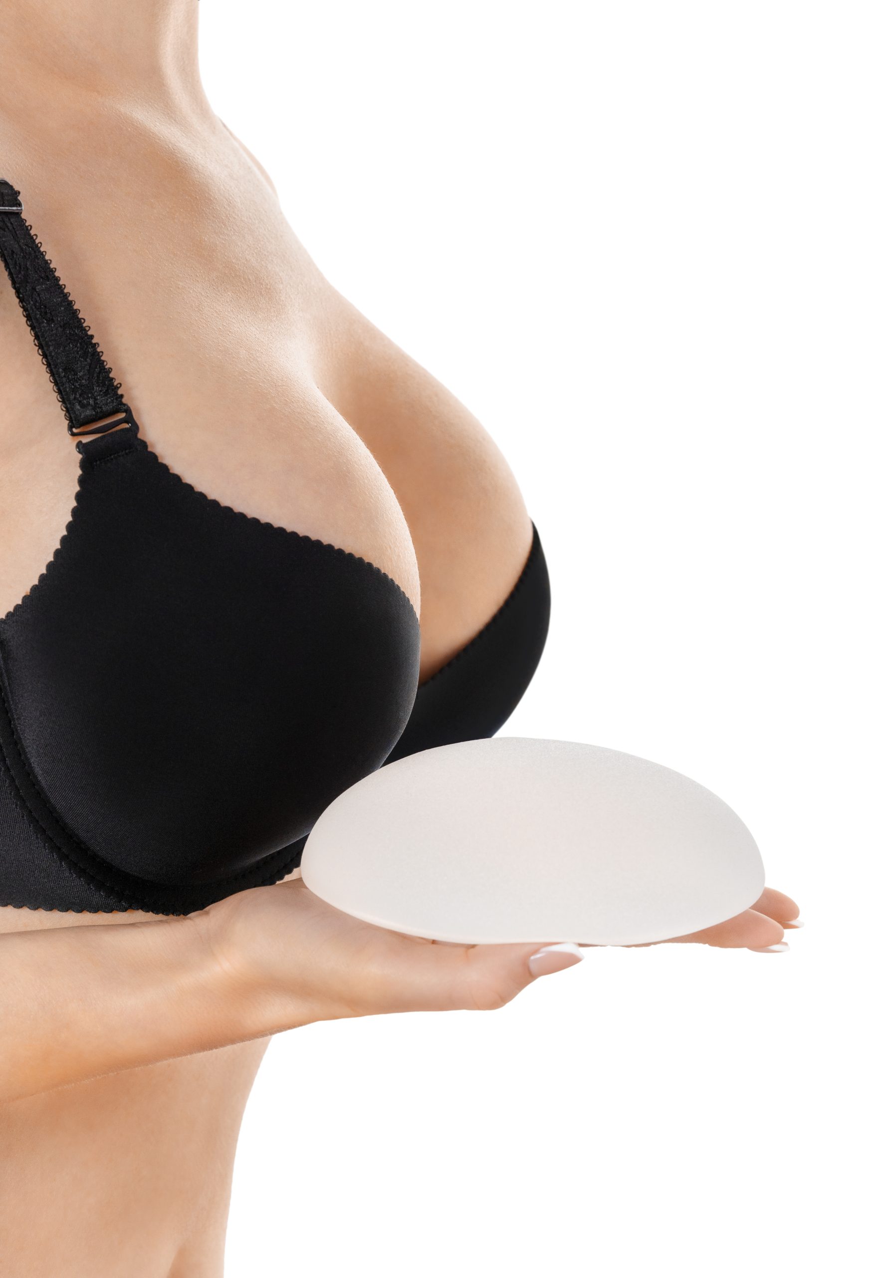 breast augmentation