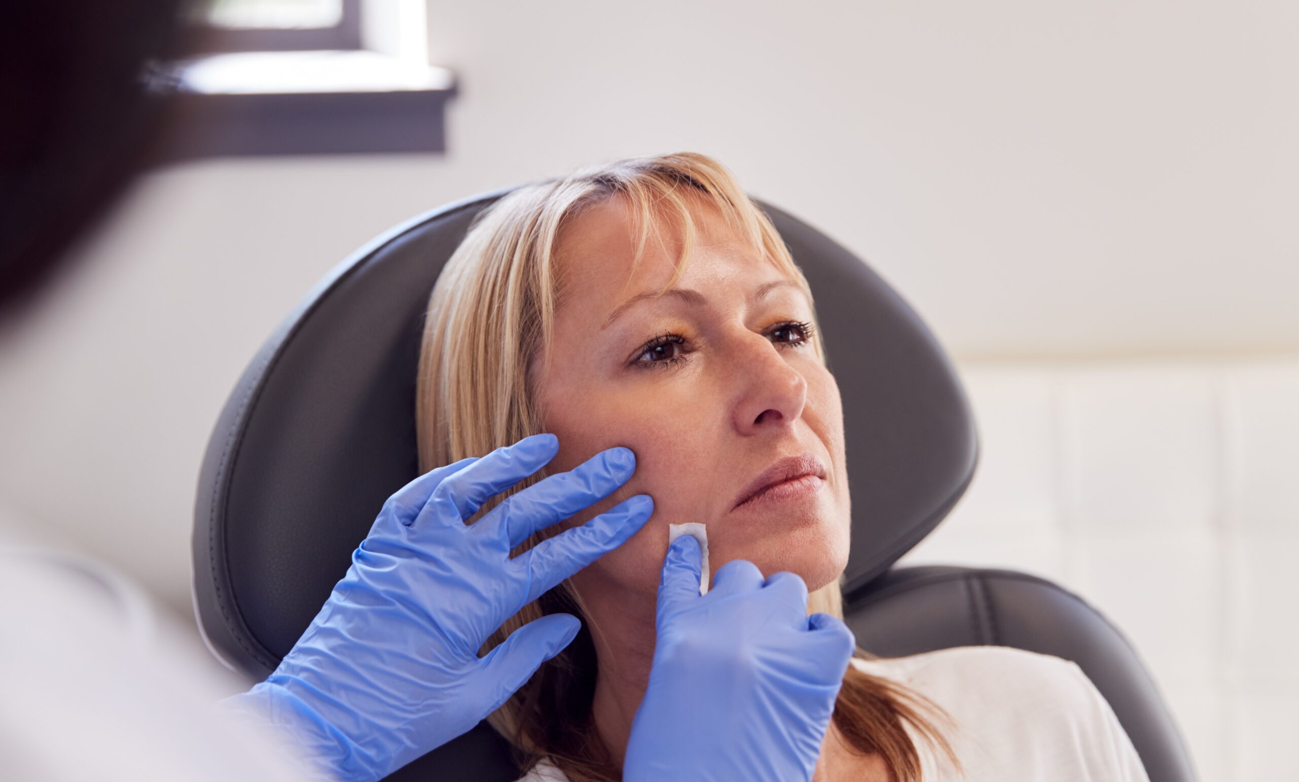 Preventative Facelift for Millennials: Why Women in Their Late 30s Are Booking Now