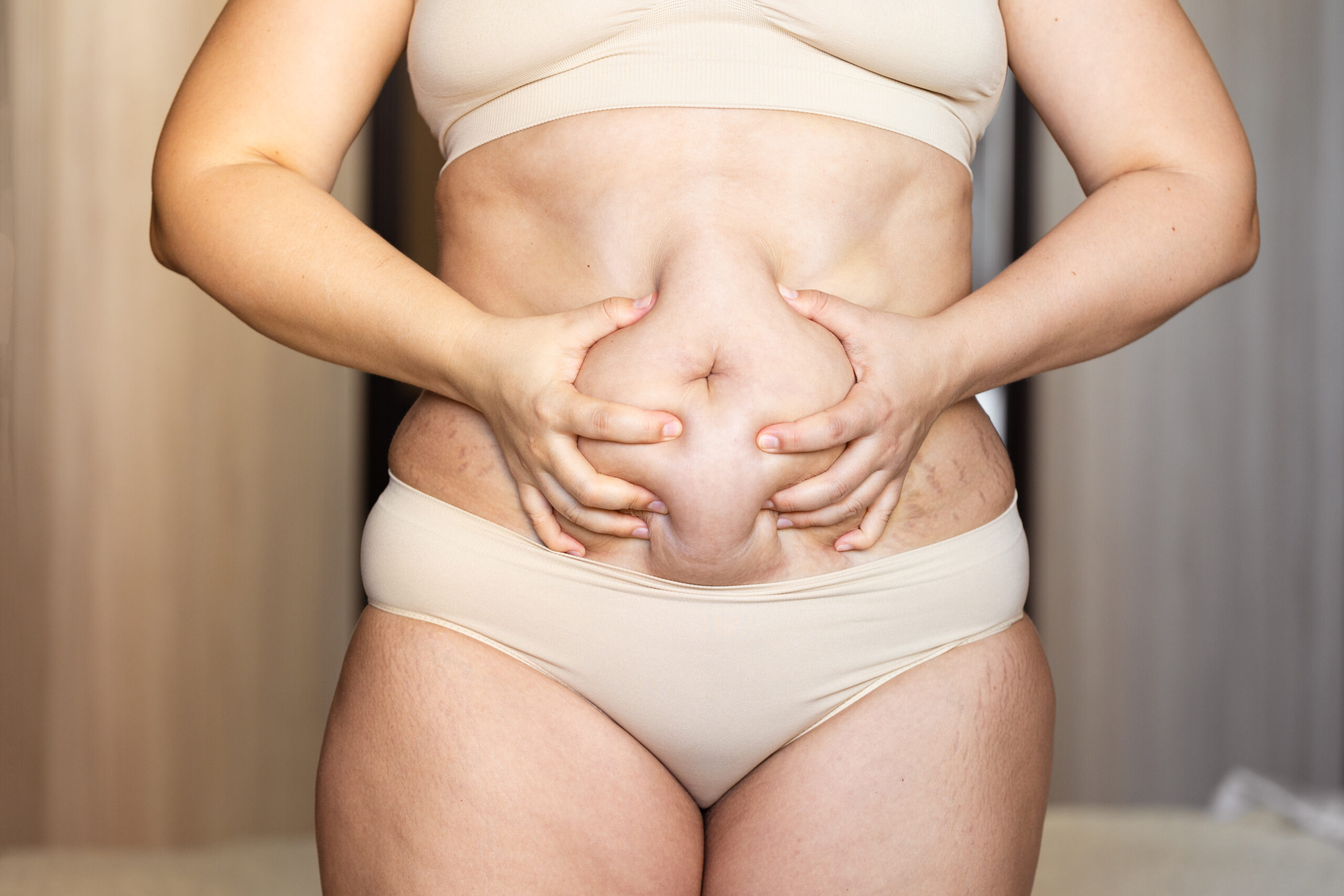 Abdominoplasty (Tummy Tuck): Restoring Confidence and Comfort at Adnova Clinic 